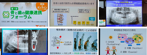 2025年10月19日　骨と歯の健康連携フォーラム