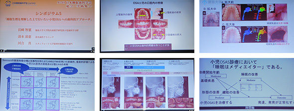 2025年11月28日 睡眠歯科学会シンポジウム