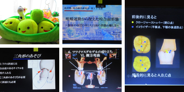 2026年5月25日　咬合療法研究会Web