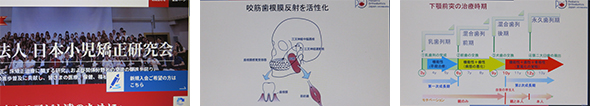 2026年3月25日　日本小児矯正研究会セミナー