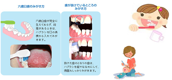 ブラッシングの注意点：六歳臼歯のみがき方・歯が抜けているところのみがき方